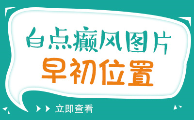 郑州专治白癜风哪里好 白癜风初期是什么症状