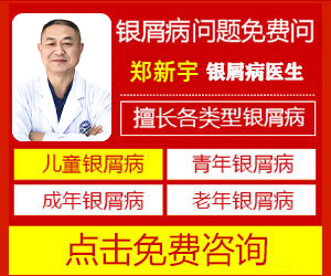 合肥哪家中医院治银屑病治的好