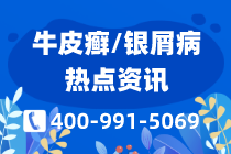 医院排名：宁波好的治疗牛皮癣的医院有哪些？排名总榜-牛皮癣关节炎肿痛怎么办？