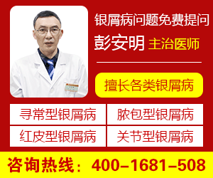 北京卫人医院治疗牛皮癣怎么样收费高吗