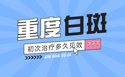 福建白癜风治疗去哪家医院好“-医生”重度白癜风治疗恢复要多长时间