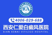 口碑热榜：西安看白癜风医院排名靠前-引起脚部白癜风因素有哪些