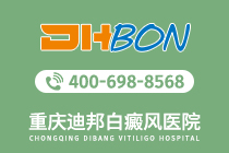 实力医院！重庆治疗白癜风的医院-白癜风休息不好会怎么样