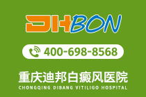 口碑榜公开！重庆治疗白癜风专业医院-青少年白癜风的症状有哪些