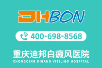 榜单公开！重庆哪家医院治疗白癜风的效果好-白癜风的诊治效果和发病时间有什么关系吗