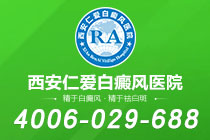 排名上升！西安市治疗白癜风医院正式名单-为什么白癜风会大面积扩散