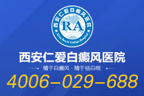 公开评选：西安市好的白癜风医院热点宣布-治疗白癜风的注意事项有哪些？