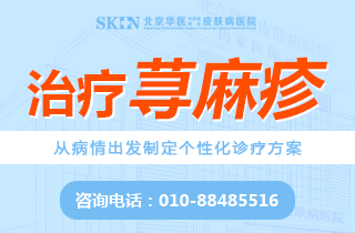 北京荨麻疹哪里看的好-腿上长了荨麻疹怎么办