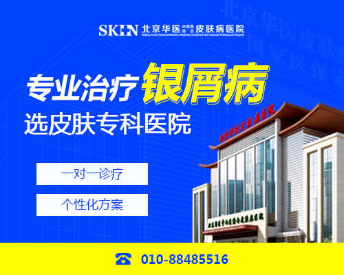 北京治疗银屑病医院怎么样?银屑病关节炎能喝牛奶吗