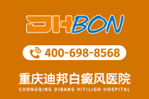 重庆在哪看白癜风好-重庆白癜风医院排名前五