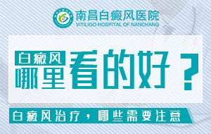 南昌白癜风医院排名更新,多家正规机构实力上榜