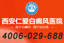 官方提醒！西安看白癜风哪个医院*好"紧急关注"使用偏方治疗白癜风会带来哪些危害