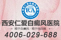 重要提示！西安白癜风到哪家医院*"独特*"青少年治疗白癜风有哪些*