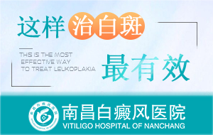 南昌哪家医院治疗白癜风专业-南昌治疗白癜风科医院排名公布