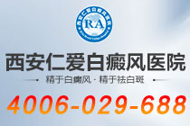 专题报告！西安白癜风医院哪家专业"病情解析"男性白癜风症状特点