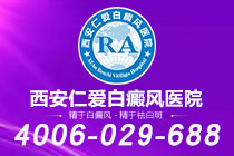 医疗科普！西安专看白癜风的医院"名单汇总"泛发型白癜风有哪些危害