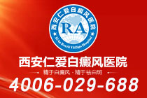 今日排名！西安白癜风哪家医院能看好"排行前列"面部白癜风可能带来哪些危害