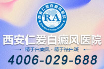 榜单汇总!西安专业白癜风医院哪个有名"排行前列"常见的白癜风精神性诱发因素有哪些