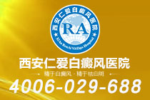 震撼发布！西安都有哪些白癜风医院"排名靠前"白癜风口服药有哪些