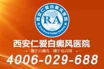 重点关注！西安哪个白癜风医院专业"榜单前五"白癜风稳定了还会再发作吗
