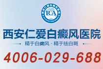 榜单上新！西安治白癜风哪家医院好"上榜名单"白癜风伍德灯下是什么颜色