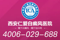 刚刚公开！西安白癜风专业正规医院"排行榜单"治疗白癜风的方法有哪些