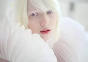 因“肤色特殊”走红的女孩